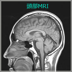頭部MRI