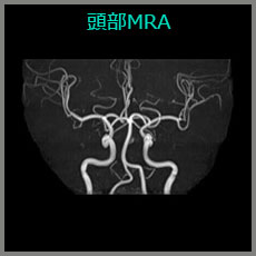 頭部MRA