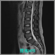 腰椎MRI