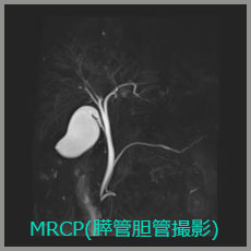 MRCP(膵管胆管撮影)