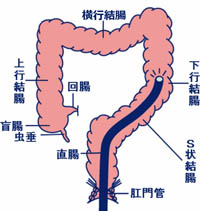 下部内視鏡検査（大腸・直腸）