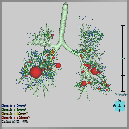 肺解析3DCluster
